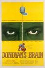 El cerebro de Donovan